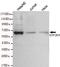 General Transcription Factor IIH Subunit 1 antibody, STJ99084, St John