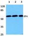 Zona pellucida sperm-binding protein 4 antibody, PA5-37086, Invitrogen Antibodies, Western Blot image 