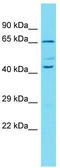 Mitogen-activated protein kinase 11 antibody, TA342153, Origene, Western Blot image 