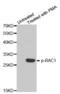 Rac Family Small GTPase 1 antibody, abx000489, Abbexa, Western Blot image 