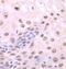Sequestosome-1 antibody, FNab06087, FineTest, Immunohistochemistry paraffin image 