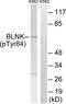 SLP-65 antibody, TA312361, Origene, Western Blot image 