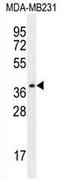 Serine Protease 3 antibody, AP53470PU-N, Origene, Western Blot image 