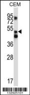X-Prolyl Aminopeptidase 3 antibody, 56-919, ProSci, Western Blot image 