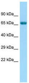 G Protein-Coupled Receptor Kinase 6 antibody, TA343155, Origene, Western Blot image 