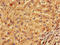 Kelch Like Family Member 2 antibody, LS-C396443, Lifespan Biosciences, Immunohistochemistry paraffin image 