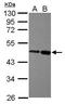 Zinc Finger And BTB Domain Containing 26 antibody, PA5-30781, Invitrogen Antibodies, Western Blot image 