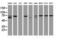 Coiled-Coil Domain Containing 93 antibody, LS-C788902, Lifespan Biosciences, Western Blot image 