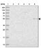 Prosaposin Like 1 (Gene/Pseudogene) antibody, PA5-58209, Invitrogen Antibodies, Western Blot image 