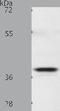Somatostatin receptor type 5 antibody, TA321266, Origene, Western Blot image 