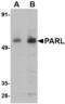 Presenilin Associated Rhomboid Like antibody, MBS150055, MyBioSource, Western Blot image 