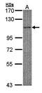 Myosin Binding Protein C, Fast Type antibody, orb73656, Biorbyt, Western Blot image 