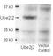 Ubiquitin Conjugating Enzyme E2 J2 antibody, GTX48692, GeneTex, Western Blot image 