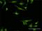 Mesencephalic Astrocyte Derived Neurotrophic Factor antibody, H00007873-M01, Novus Biologicals, Immunocytochemistry image 