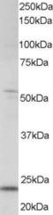 MAX Dimerization Protein 4 antibody, EB05652, Everest Biotech, Western Blot image 