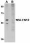 Schlafen Family Member 12 antibody, LS-B4757, Lifespan Biosciences, Western Blot image 