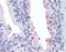 RTKN antibody, orb89678, Biorbyt, Immunohistochemistry paraffin image 