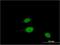 BUD23 RRNA Methyltransferase And Ribosome Maturation Factor antibody, H00114049-M11, Novus Biologicals, Immunocytochemistry image 