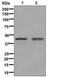 Glutamate-Ammonia Ligase antibody, A03191-2, Boster Biological Technology, Western Blot image 
