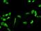 Phosphoglycerate Dehydrogenase antibody, ab57030, Abcam, Immunocytochemistry image 