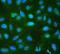 RP2 Activator Of ARL3 GTPase antibody, A01923-1, Boster Biological Technology, Immunofluorescence image 