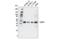 ACAT-1 antibody, 35695S, Cell Signaling Technology, Western Blot image 