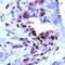 Fms Related Tyrosine Kinase 1 antibody, PA1-37710, Invitrogen Antibodies, Immunohistochemistry frozen image 