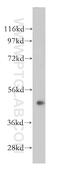 RNA-binding protein NOB1 antibody, 14456-1-AP, Proteintech Group, Western Blot image 