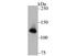 UPF1 RNA Helicase And ATPase antibody, A00900, Boster Biological Technology, Western Blot image 