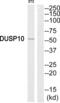 Dual Specificity Phosphatase 10 antibody, abx015076, Abbexa, Western Blot image 