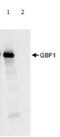 Golgi Brefeldin A Resistant Guanine Nucleotide Exchange Factor 1 antibody, ab86071, Abcam, Immunoprecipitation image 