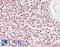 BMI1 Proto-Oncogene, Polycomb Ring Finger antibody, LS-B14785, Lifespan Biosciences, Immunohistochemistry paraffin image 