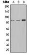 Nephrocystin 1 antibody, MBS821402, MyBioSource, Western Blot image 