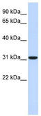 Carbonic Anhydrase 8 antibody, TA346372, Origene, Western Blot image 