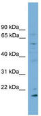 Cytochrome P450 Family 2 Subfamily R Member 1 antibody, TA338658, Origene, Western Blot image 