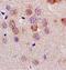 LLGL Scribble Cell Polarity Complex Component 1 antibody, orb101863, Biorbyt, Immunohistochemistry paraffin image 