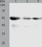 Prolylcarboxypeptidase antibody, TA322678, Origene, Western Blot image 