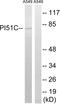 Phosphatidylinositol-4-phosphate 5-kinase type-1 gamma antibody, LS-C120214, Lifespan Biosciences, Western Blot image 
