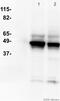 Keratin 8 antibody, ab9023, Abcam, Western Blot image 