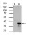 Non-Homologous End Joining Factor 1 antibody, GTX100092, GeneTex, Immunoprecipitation image 