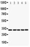 E2F Transcription Factor 6 antibody, PA1811, Boster Biological Technology, Western Blot image 