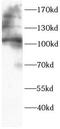 ADAM 17 antibody, FNab10431, FineTest, Western Blot image 