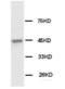Keratin 18 antibody, orb18204, Biorbyt, Western Blot image 