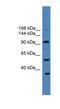 Ubiquitin Specific Peptidase 29 antibody, NBP1-79748, Novus Biologicals, Western Blot image 