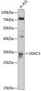 Voltage Dependent Anion Channel 3 antibody, 13-710, ProSci, Western Blot image 