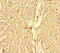 Carnitine Palmitoyltransferase 1A antibody, LS-C677588, Lifespan Biosciences, Immunohistochemistry paraffin image 