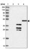 DnaJ Heat Shock Protein Family (Hsp40) Member C3 antibody, NBP2-48734, Novus Biologicals, Western Blot image 