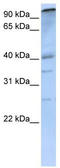 Lysine Acetyltransferase 2B antibody, TA344545, Origene, Western Blot image 