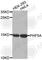 PHD finger-like domain-containing protein 5A antibody, A2333, ABclonal Technology, Western Blot image 