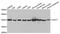 Sterol O-Acyltransferase 1 antibody, LS-C333990, Lifespan Biosciences, Western Blot image 